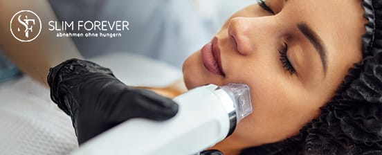 Radiofrequenz mit Microneedling