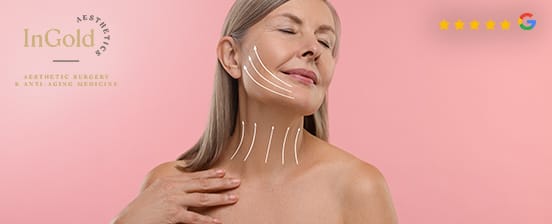 PDO-Fadenlifting ohne OP und Ausfallzeiten