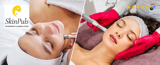 Microneedling – optional mit Microdermabrasion