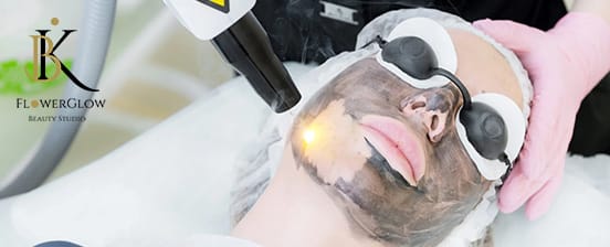 Carbon Peeling – das Hollywood Peel